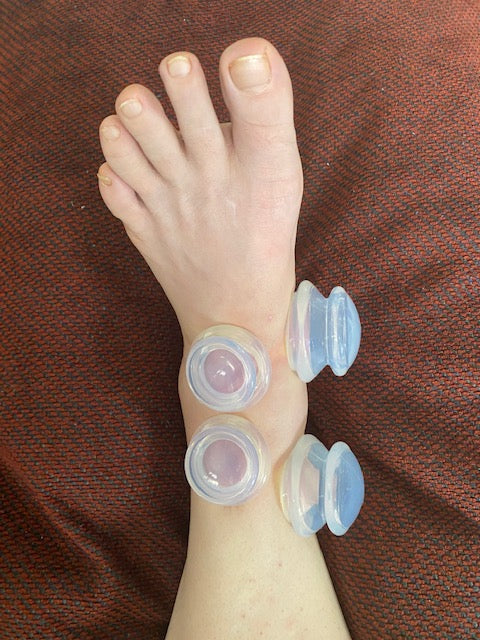 Total Ankle Replacement: Phase 4: Decrease Scar Adhesions: Increase Flexibility
